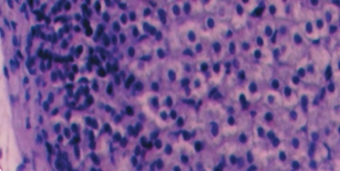 Рис. 5. Группа животных с иммуносупрессией. <br>Сохраненная структура надпочечника, увеличение <br>лимфоидных клеток в корковой зоне, утолщение <br>соединительнотканной оболочки (окраска <br>гематоксилин и эозин, *400)