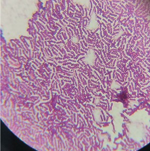 Рис. 2. Klebsiella под микроскопом (окраска по <br>Грамму)