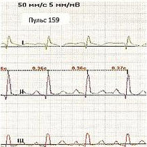  50       <br>0,5  0,25%-   1    <br>