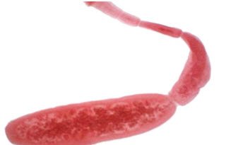 Рис. 3. Ларвоциста Echinococcus granulosu
