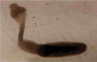 Рис. 4. Alveococcus multilocularis