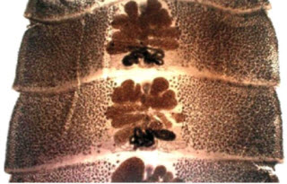 Рис. 11. Зрелый членик Dibhillobothrium latum