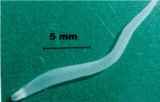 Рис. 13. Плероциркоид Diphillobothrium latum