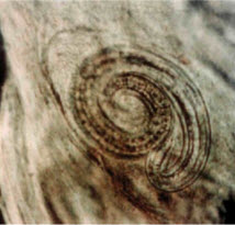 . 18.  Tritchitnella spiralis
